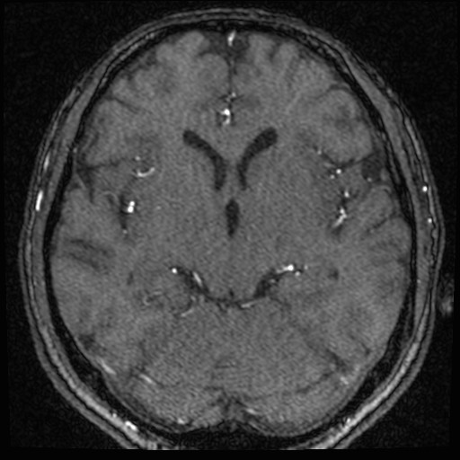 Click on the Serie image to view the images of VILLANUEVA, WILLIAM A.